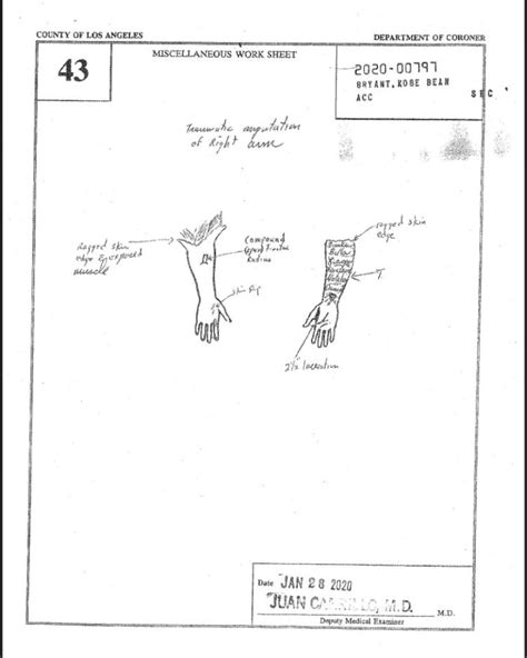 kobe and gigi autopsy|Kobe Crash Autopsy Reports : r/CrimeScene